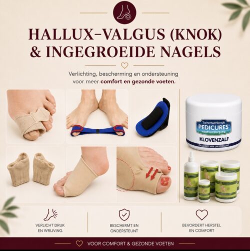 Hallux -valgus (knok) -ingegroeide nagels