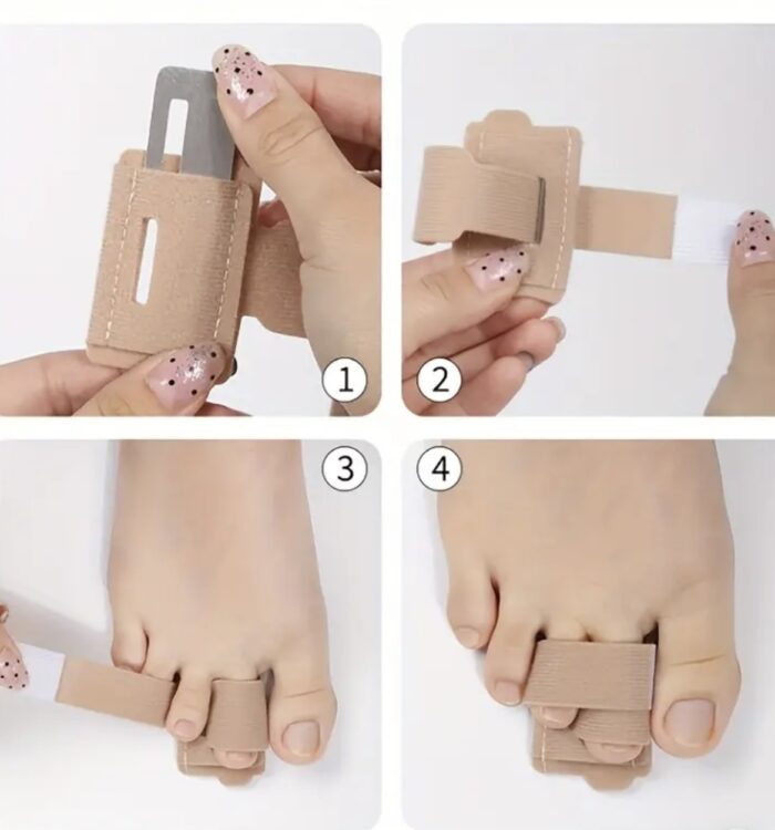 Hamer/gebroken teen/vinger correctie - Afbeelding 8